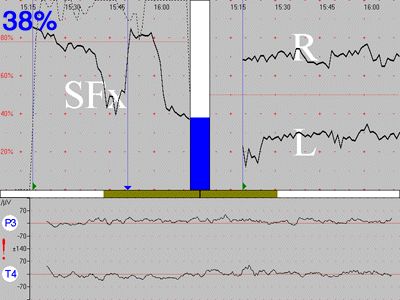 SFX Screen